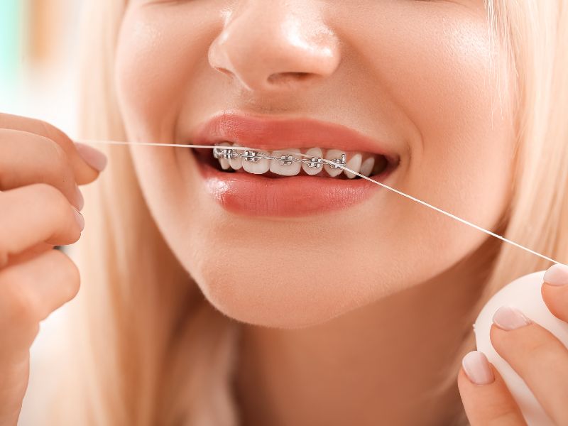 orthodontie clichy