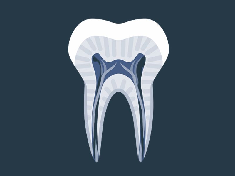 endodontie clichy